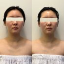 메리엘스킨케어 | [구미웨딩관리/구미경락/구미목어깨관리]구미 형곡동 웨딩관리 추천, 메리엘 스킨케어 후기