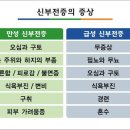 심부전증 이미지