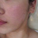 라헬스킨케어