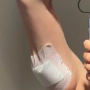 유라인의원 | 유라인의원 팔뚝컷 4️⃣회차(내돈내산후기)