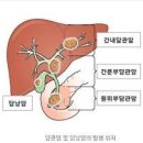 담낭암 원인 예방 이미지