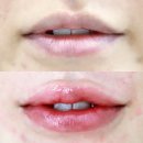 양재(주간) | 양재입술 추천| 톤업을 넣은 첫 입술컬러 후기 은은희브로우