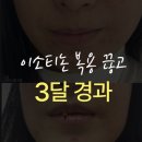 이소약국 이미지