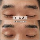 서울에이스병원 | [에이스왁싱] 비건, 천연 제품 사용하는 정발산 왁싱 남자 눈썹 후기