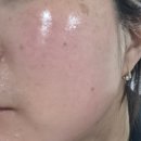 버블버블 | 맥스클리닉 멜라토닌샷 글로우 버블 마스크팩 후기