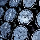 더(The) 메디칼 이미지