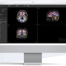 투자 | K-바이오 부활 신호탄…IPO·대규모 투자 활황 | 뉴스1 이미지