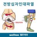 전방십자인대파열 증상, 관절내시경으로 전방십자인대파열 치료하세요,관절내시경이란?? 이미지