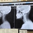 중앙마취통증의학과 | 부천 역곡역 연세안마취통증의학과 방문 후기,어깨 통증 치료 후기