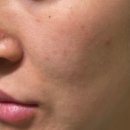 세라헤어라인 이미지