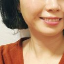 수진가새란약국 | 잠실 피부과 인모드fx 울쎄라리프팅후기