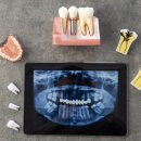 포도나무치과의원 이미지