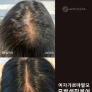 모스테틱광주