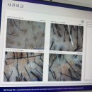 효명레이저 | 인천탈모 구월동탈모 구월동탈모관리 구월동두피센터 구월동두피관리 모바이오 인천구월본점 후기