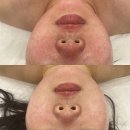 미니스톱 울산문화점 | 피부관리 온전 에스테틱 울산본점 울산 남구 달동 가격위치주소이벤트할인 총정리