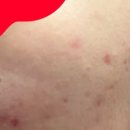 타토아의원 용인점 이미지