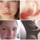 피부야 놀자 이미지