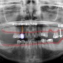 CORE 치과기공소 이미지