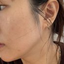 T.스테이션 송현점 | 달서구 피부관리실 추천! 홍조·모공·푸석함까지 잡아주는 혜윰 스킨케어 물방울 관리 후기