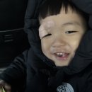 자이언성형외과의원 네이버블로그