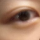 향남밝은안과의원 이미지