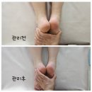 천안아산 출장 산후마사지 후기 마미라인 홈케어