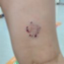 남양주경찰서(민원) | 개물림사고 피해자 과실치상죄 남양주경찰서 고소장 접수 후기