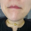 향남한의원 | 향남피부과 미쥬란 후기, 속건조 개선 스킨부스터 솔직 후기