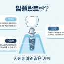 본리치과 네이버블로그