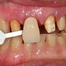 서울가족치과기공소 이미지