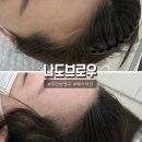 2454 | (노단머) 대전 도안동 헤어라인 잘하는곳 나도브로우 방문 후기