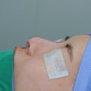 지앤지광고 | 자가늑코수술 비용과 선택 기준은?