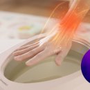 비오아이 이미지