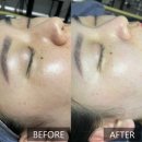 사림민원센터옆 노외주차장 | 창원 용호동 피부관리 [모공케어 : 어울림뷰티]