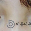 인아웃
