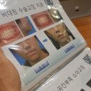 연세엔서울치과교정과치과의원 네이버블로그