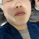 기흥역피부관리 더에스뷰티 스킨&amp;왁싱 물방울리프팅