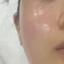 400 | 부산 올타이트리프팅 400샷 내돈내산 리얼후기