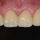 SKY치과기공소 이미지