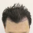 부산 맘모스헤어라인의원 이미지