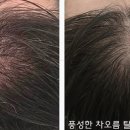 차오름 scalp & skin