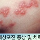 올림픽정형외과의원 네이버블로그