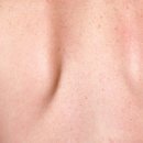 멍이날개 이미지