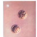 11260-2-1-8 | [시험관 일기_8차(신4,동4)] ② 프롤루텍스 주사 대신 타이유 주사 맞으러 병원 퐁당퐁당