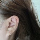 귀 건강학(이혈테라피) | 귀지압패치,이혈테라피 이혈기석 후기