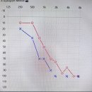 시그니아독일보청기 관악센터 이미지