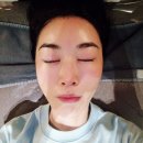부산서면피부과 유스힐 스킨부스터 후기: 자연스럽게 빛나는 피부를 찾아서