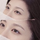 시연의원 | 잠원동 방배동 눈썹문신 잘하는곳 입술문신 가격 후기
