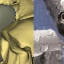 서울탑치과 이미지