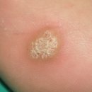 올뷰티의원대전유성 이미지